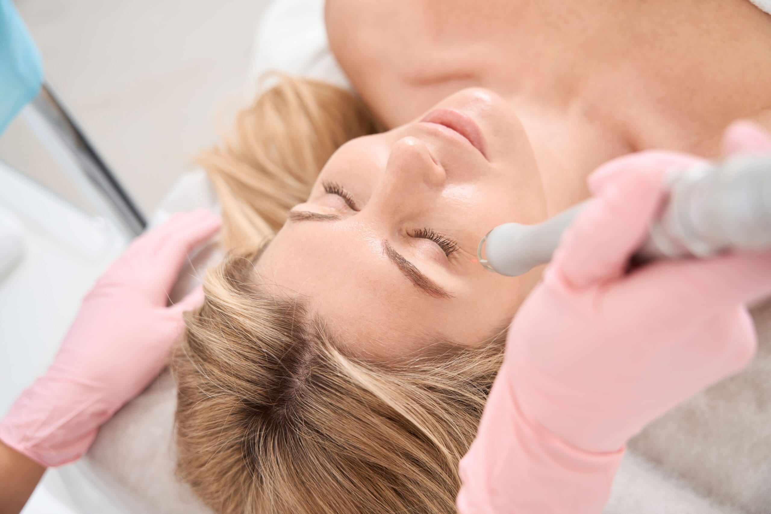 Laser Skin Resurfacing for Acne Scars: What You Need to Know