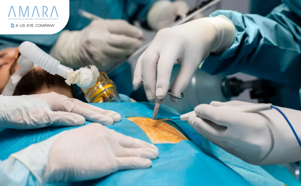 Mohs Surgery in Venice, FL by Amara Doctors